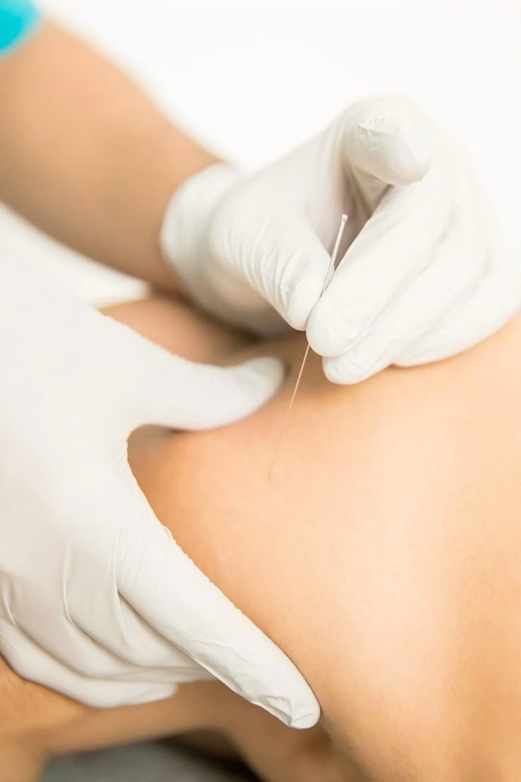 07aad8f9fcdbaedbcbe3574722a6a518